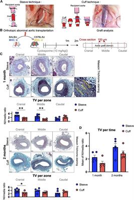 A minor tweak in transplant surgery protocols alters the cellular landscape of the arterial wall during transplant vasculopathy